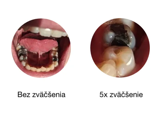 Lupy – 10. Máj 2021